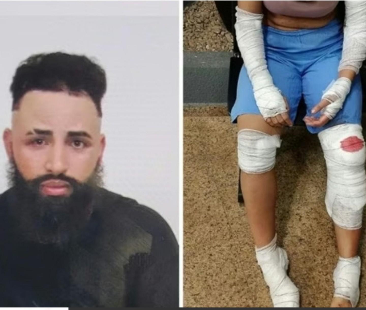 Mulher pula de carro em movimento a 100km/h para fugir de tentativa de feminicídio em Paulínia